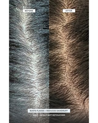 Scalp Revival MegaStrength+ Dandruff Relief Shampoo 8.4 oz.