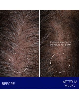 The Scalp Treatment 1 oz.