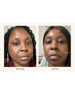 Superkind Daily Essentials Kit ($157 value)