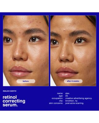 Retinol Correcting Serum 1 oz.