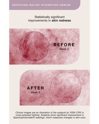 Soothing Relief Hydration Serum 1 oz.