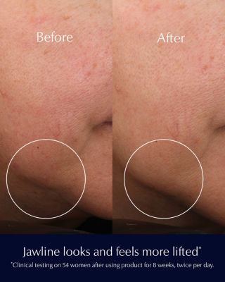 Nightly Renewal Skincare Set ($197 value)