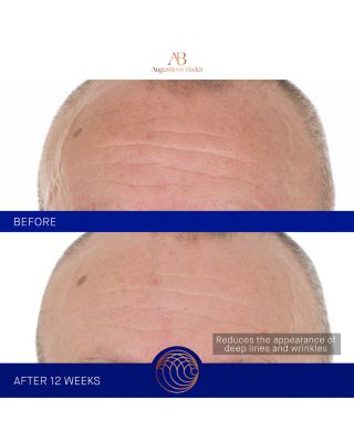 The Retinol Serum 0.5 oz.