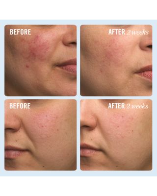 Ultra Repair Cream 2 oz.