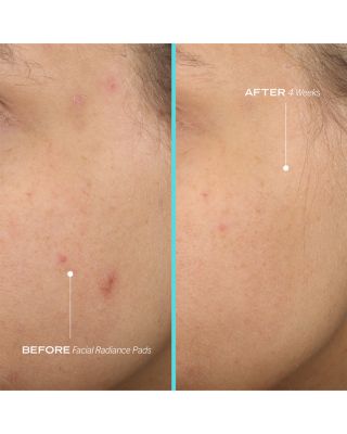 Facial Radiance Pads with Glycolic &amp; Lactic Acids Exfoliating Pads with AHA