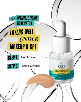 Truly Targeted Acne Clearing Solution with Salicylic Acid 0.5 oz.