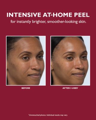 Even Smoother Instant Reveal Facial Peel, Pack of 8