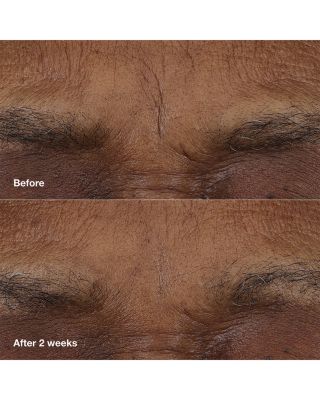 Smart Clinical Repair™ AM/PM Retinoid Balm