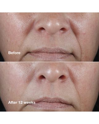 Smart Clinical Repair Wrinkle Correcting Rich Cream 1.7 oz.