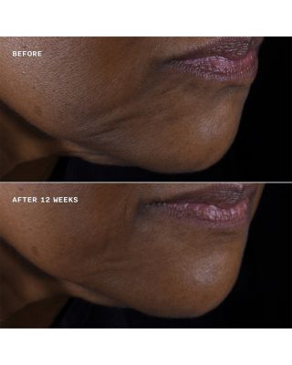 Smart Clinical Repair Lifting Face + Neck Cream 2.5 oz.