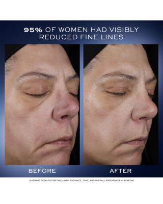 G&eacute;nifique Ultimate Recovery Serum 1.7 oz.