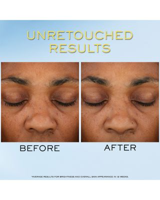 UV Expert Supra Screen Invisible Sunscreen Serum SPF 50 1.7 oz.