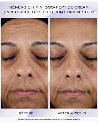 R&eacute;nergie x G&eacute;nifique Skincare Starter Set ($138 value)