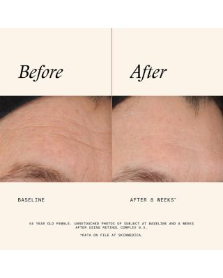 Retinol Complex 0.5 1 oz.