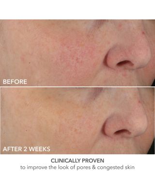 Advanced Retinol + Ferulic Perfectly Dosed Retinol Peel (Universal 0.2% Pure Retinol), Set of 8