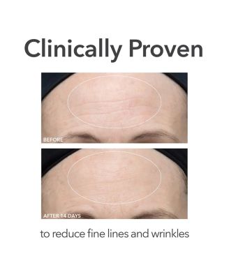 Alpha Beta Ultra Gentle Daily Peel, 30 Treatments