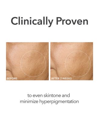 Alpha Beta Extra Strength Daily Peel, 5 Pads