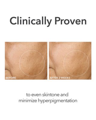 Alpha Beta Extra Strength Daily Peel, 30 Pads