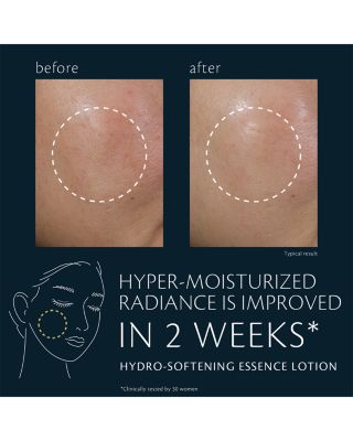 Hydro Softening Essence Lotion 5.7 oz.