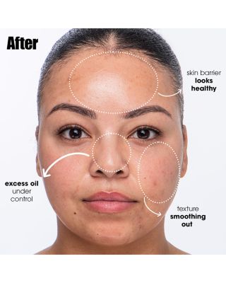 Breakout Breakup Purifying Salicylic Acid Cleanser 5 oz.