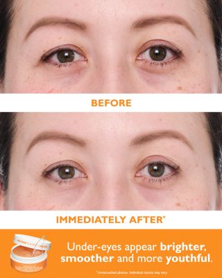 Full Size Vitamin C & Hyaluronic Eye Patches Kit  ($120 value)