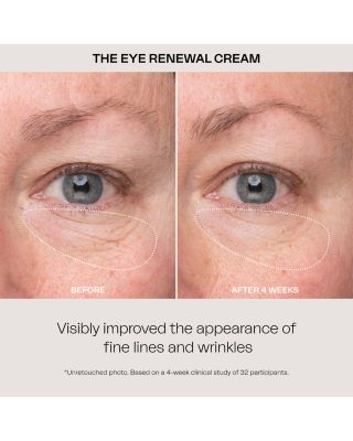 Eye Renewal Cream 0.5 oz.