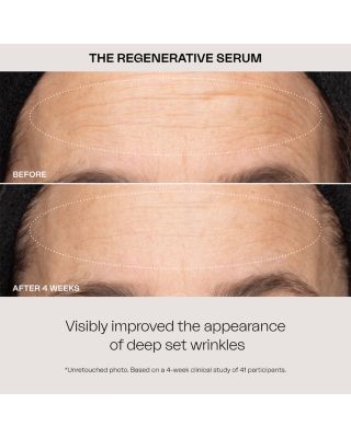 Regenerative Serum 3.3 oz.