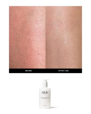  Fragrance Free Instant Peel