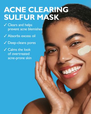 Goodbye Acne™ Therapeutic Sulfur Mask 5.1 oz.