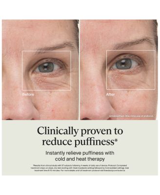 The Radiant Renewal TheraFace Depuffing Wand & Mask Gift Set