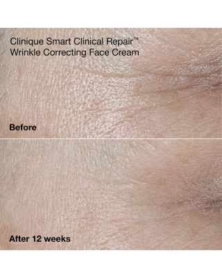 Smart Clinical Repair Mini Skincare Gift Set ($71 value)