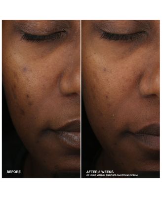 Vitamin Enriched Smoothing Serum with Niacinamide 1.01 oz.