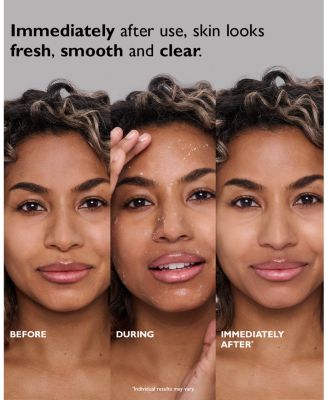 FIRMx Peeling Gel 3.4 oz.