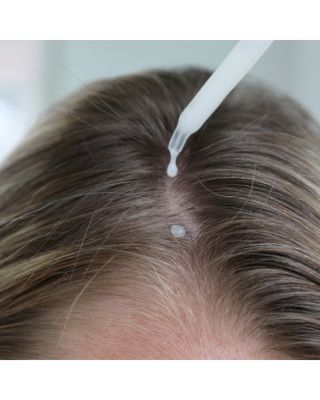 Topical Scalp Supplement 2 oz.