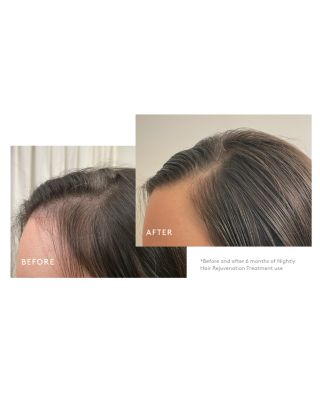 Flourish Nightly Intensive Hair Rejuvenation Treatment - 90 Days