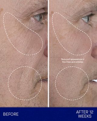 The Serum Full Pack 1 oz.