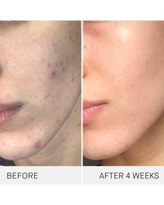 The Cream Mini Routine Skincare Gift Set ($232 value)