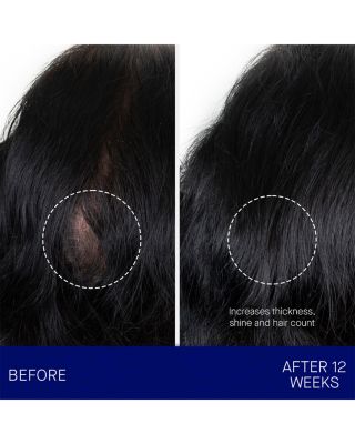 The Scalp Treatment 1 oz.