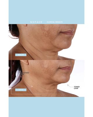 Limited Edition Mini+ Facial Toning Device &amp; Primer - Pink