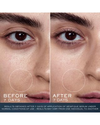 Advanced G&eacute;nifique Youth Activating Serum 1.7 oz.