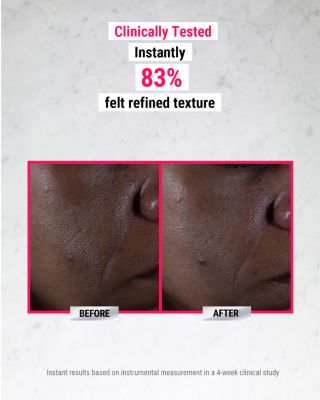 Ultra Pure High-Potency Serum 9.8% Glycolic Acid 1 oz.