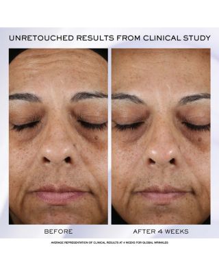 R&eacute;nergie H.P.N. 300-Peptide Anti-Aging Cream 1.7 oz.