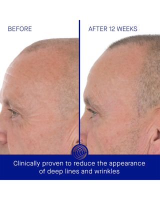 The Retinol Serum 1.7 oz.