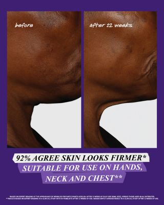 Retinol Skin-Renewing Daily Micro-Dose Serum 1.7 oz.