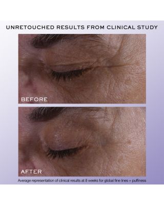 R&eacute;nergie H.C.F. Triple Serum Eye 0.67 oz.