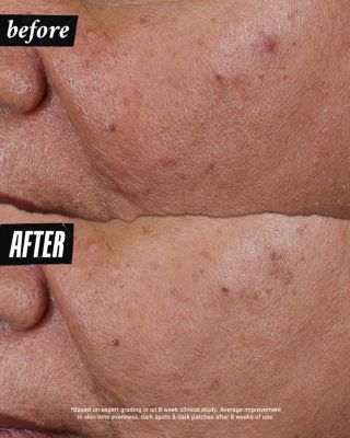 Auto Tone Discoloration & UV Solution 1.4 oz.