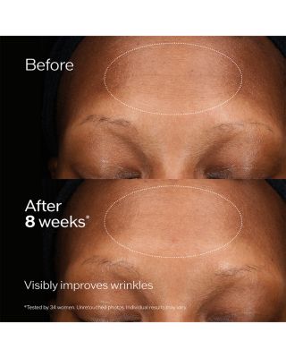 Future Solution LX Regenerating Cream Set ($437 value)