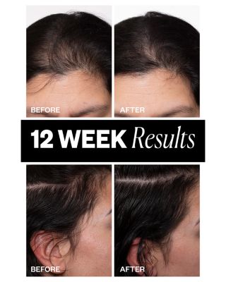 Sponsored High Density Scalp Treatment 2.1 oz.