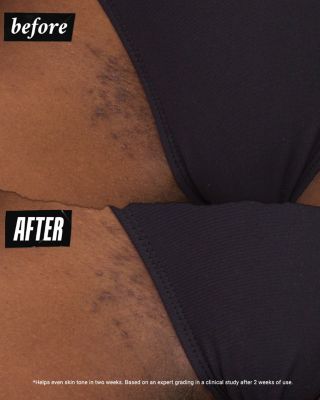 Ingrown Hair & Tone Correcting Intimate Drops 1 oz.