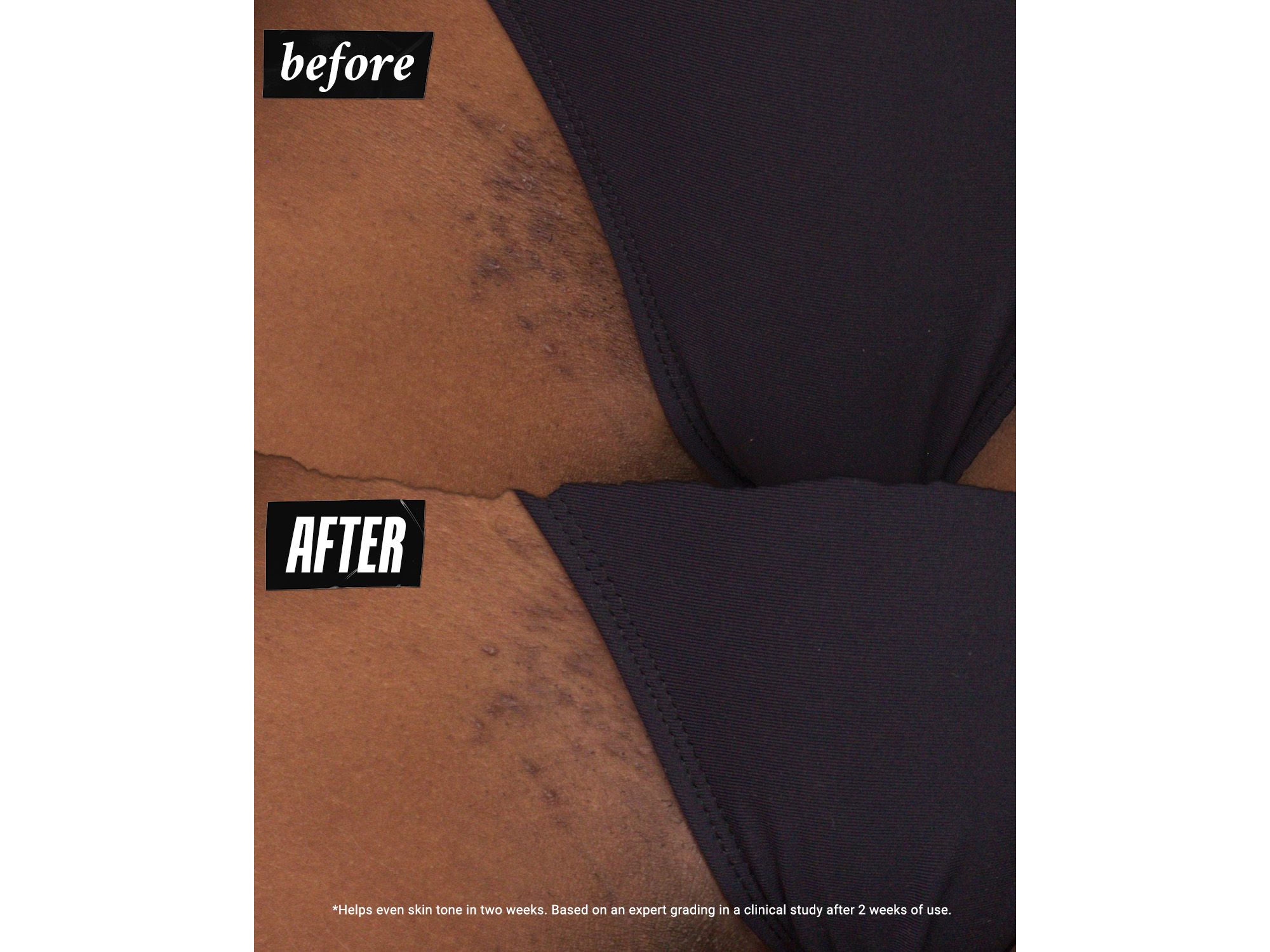 Ingrown Hair & Tone Correcting Intimate Drops 1 oz. — Image 7